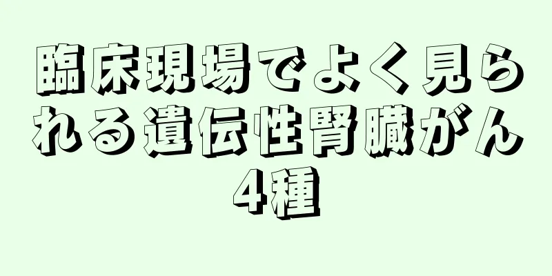 臨床現場でよく見られる遺伝性腎臓がん4種