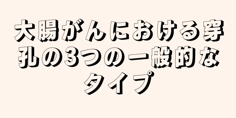 大腸がんにおける穿孔の3つの一般的なタイプ