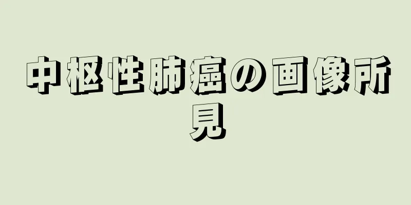 中枢性肺癌の画像所見