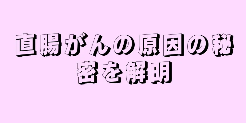 直腸がんの原因の秘密を解明