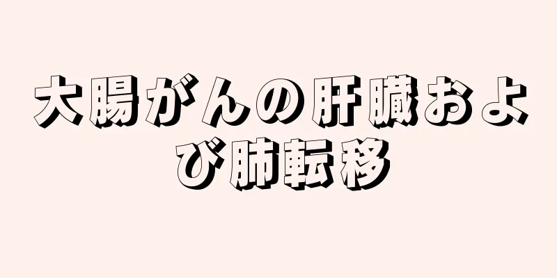 大腸がんの肝臓および肺転移
