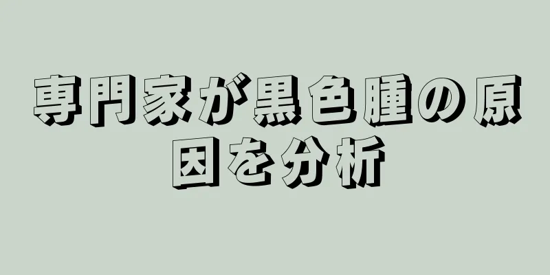 専門家が黒色腫の原因を分析