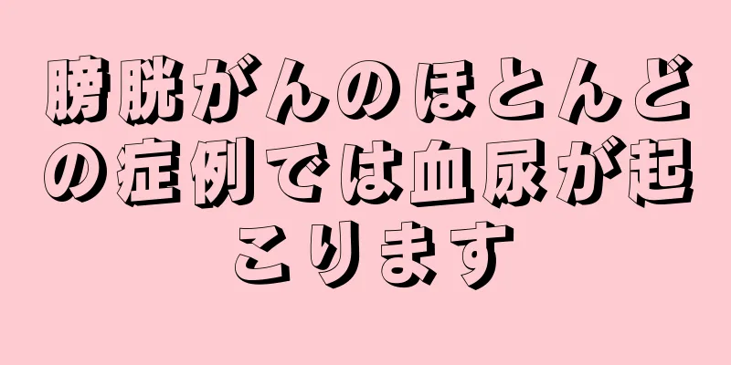 膀胱がんのほとんどの症例では血尿が起こります