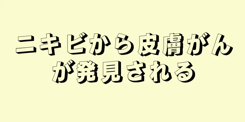 ニキビから皮膚がんが発見される
