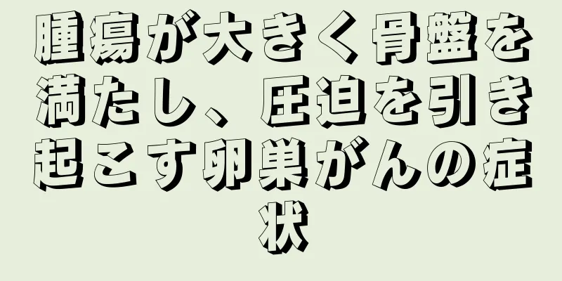 腫瘍が大きく骨盤を満たし、圧迫を引き起こす卵巣がんの症状