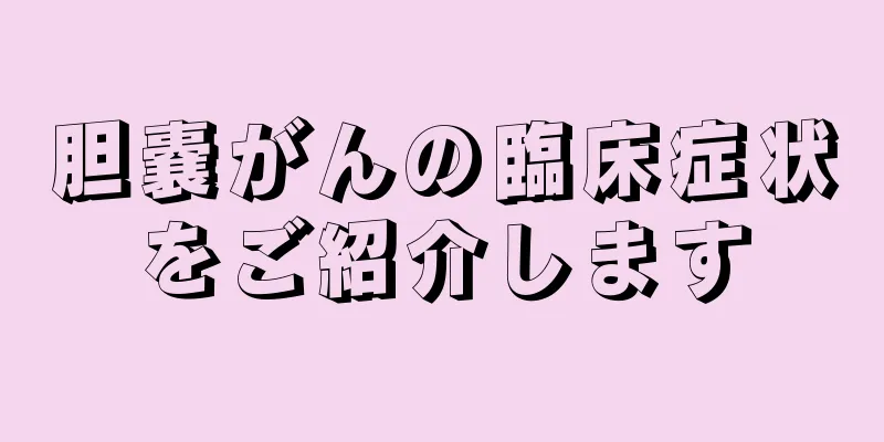 胆嚢がんの臨床症状をご紹介します
