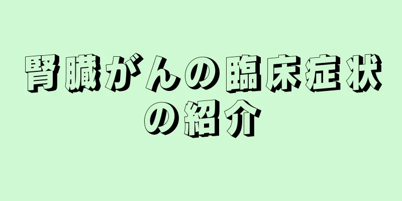 腎臓がんの臨床症状の紹介